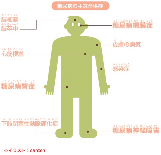 糖尿病網膜症